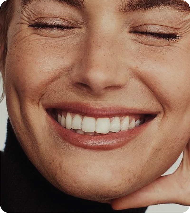 Smile Makeovers & Rehabilitation